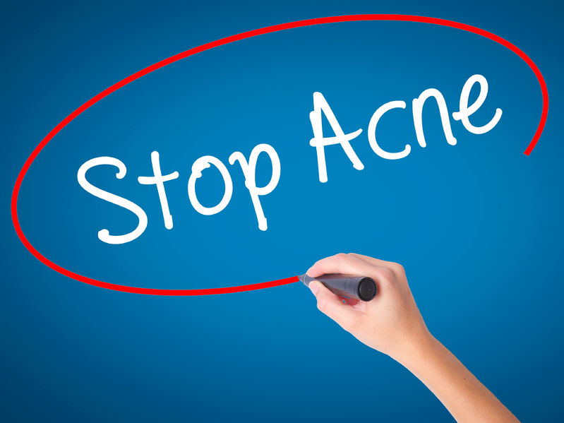 Question & Answer: Acne and Aging