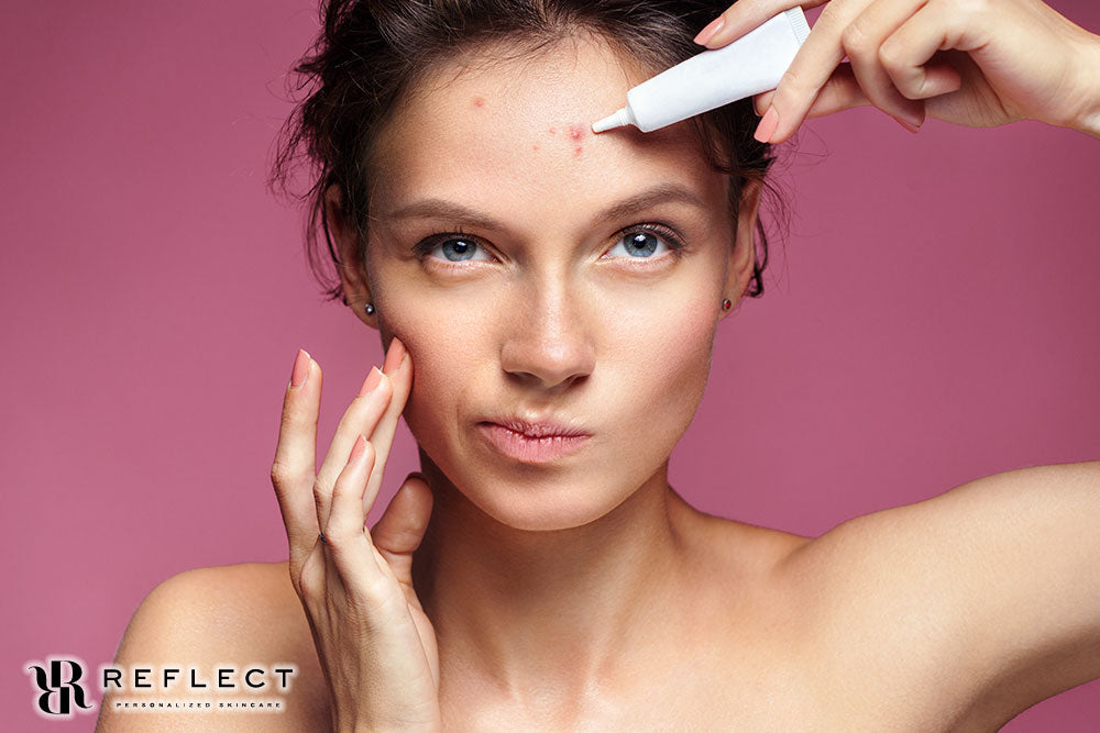 When it Comes to Acne Treatment, Reflect Personalized Skin Care Cares About it All!